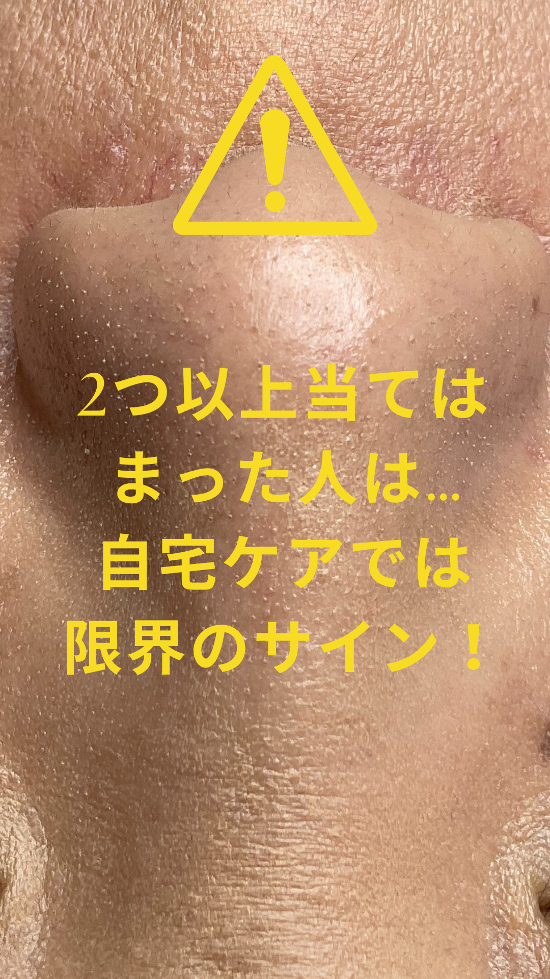 【もう隠さない！】ファンデが毛穴で「ぶつぶつ・毛穴落ち」する本当の原因とMIAJUの最短解決策
