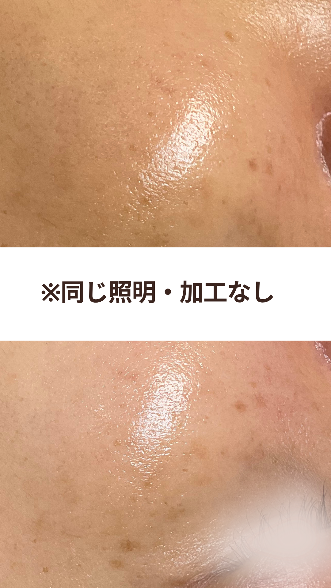 夕方くすみが気になる40代へ｜原因は産毛？栃木市MIAJU